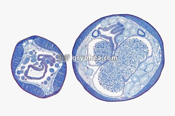 Ascaris du Cheval - ver parasite - mâle et femelle CT x2 - gryphea.org